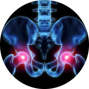 hip pain treatment Springfield IL