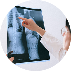 Scoliosis